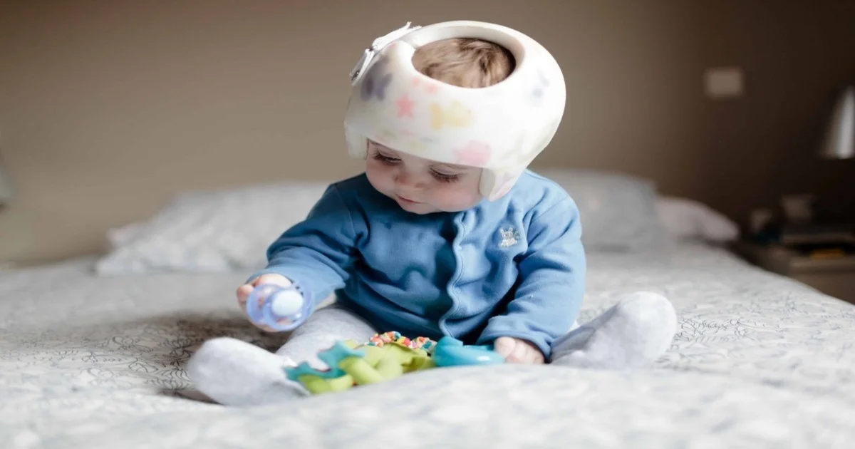 How to Fix Baby's Flat Head Without a Helmet7 Gentle Solutions for